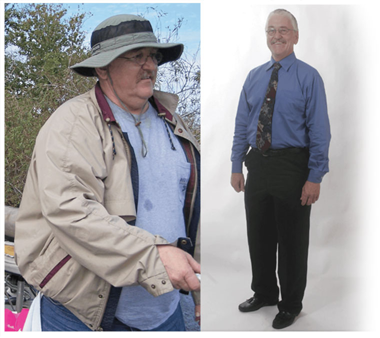 Darrylbeforeafter