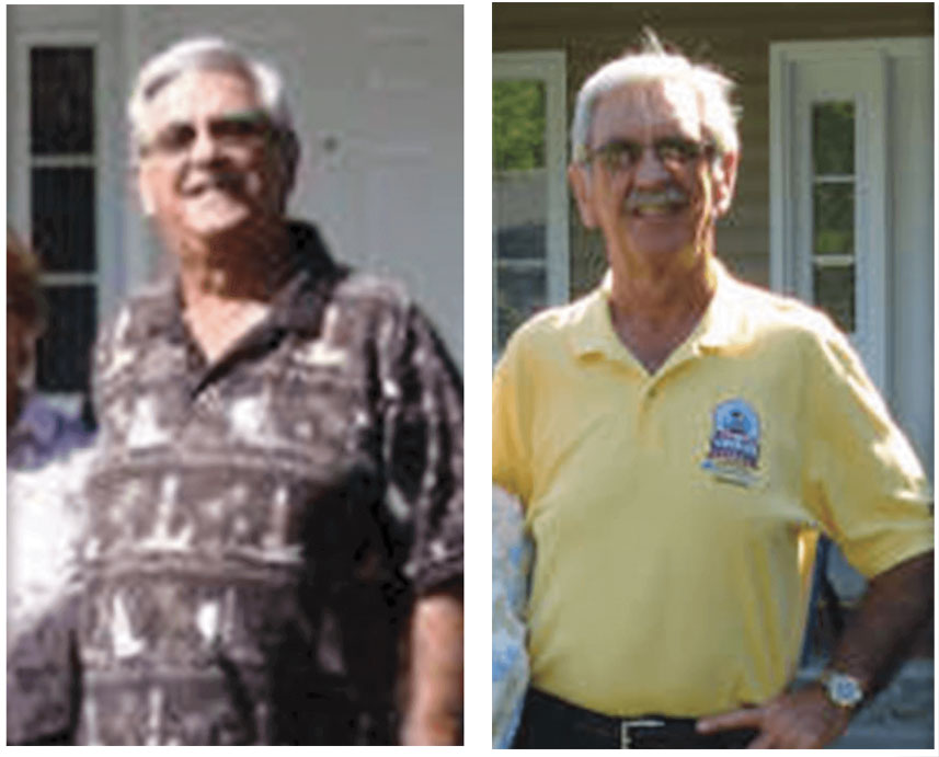 Don-before-after