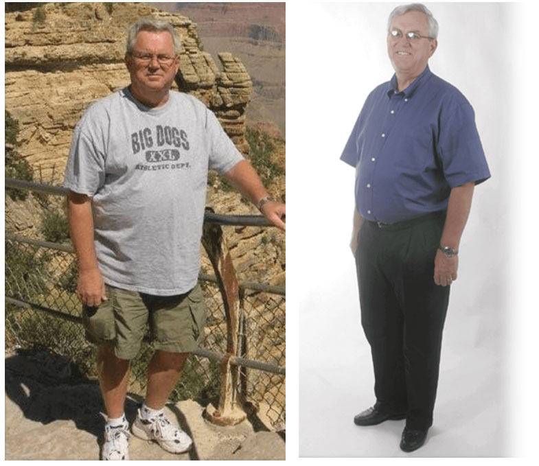 Dougbefore-after