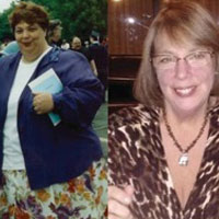 cathy-gastic-bypass-testimonial